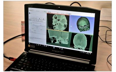 EL MANEJO DE MILES DE DATOS CAMBIARÁ LA MEDICINA EN EL FUTURO