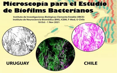 CURSO BINACIONAL – MICROSCOPIA PARA EL ESTUDIO DE  BIOFILMS BACTERIANOS